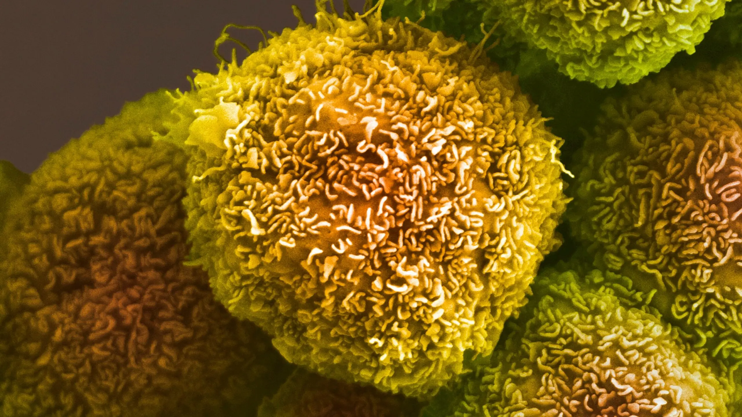 Latest Advances in the Search for a Pancreatic Cancer Cure